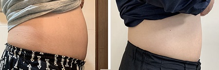 空氣微雕-小腹消消