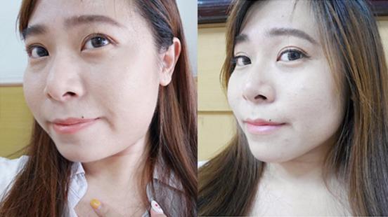 不小心被養肥的雙下巴就靠空氣微雕♡台中東區人生中醫